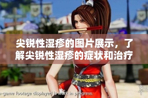 尖锐性湿疹的图片展示，了解尖锐性湿疹的症状和治疗方法