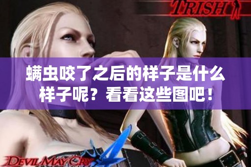 螨虫咬了之后的样子是什么样子呢？看看这些图吧！